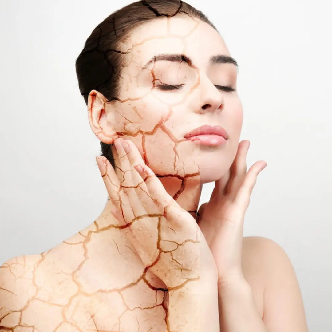 Dry Skin